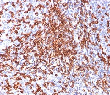 Anti-CD44 / HCAM, clone 156-3C11