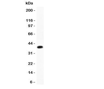 Anti-Cathepsin D