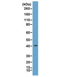 Anti-Core Histone Macro H2A.1 (H2AFY), clone RM248 (recombinant antibody)