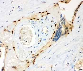 Anti-MSK1