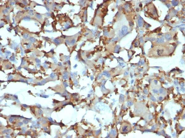 Anti-CD68 (Macrophage Marker), clone KP1 + C68/684