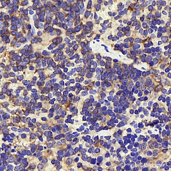 Anti-INPP5D