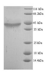 Alcohol dehydrogenase class-3 (ADH5), human, recombinant