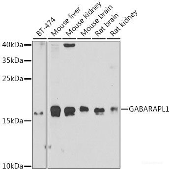 Anti-GABARAPL1