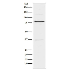Anti-Insulin Receptor Related / INSRR, clone ADOI-9