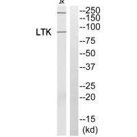 Anti-LTK