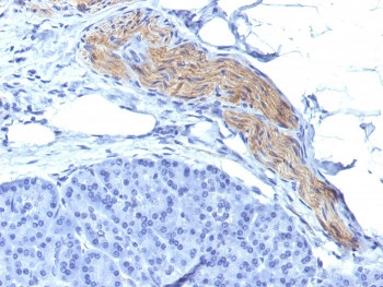 Anti-NCAM / CD56, clone NCAM1/795