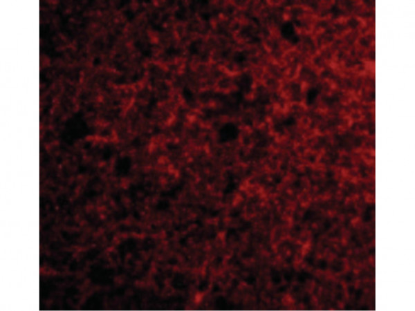 Anti-Neurotrypsin