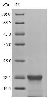 Latent membrane protein 2 (LMP2), partial, Epstein-Barr virus, recombinant