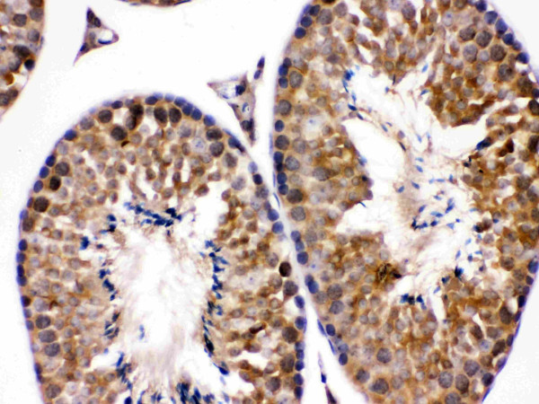 Anti-Endothelin B Receptor