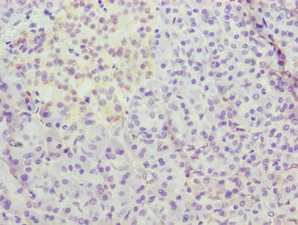 Anti-METTL25