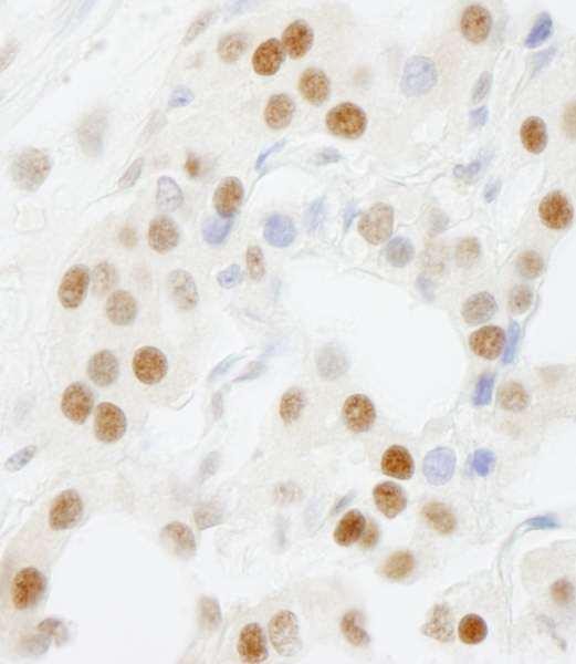 Anti-GTF3C5/TFIII1C63 IHC Antibody, affinity purifie (IHC)