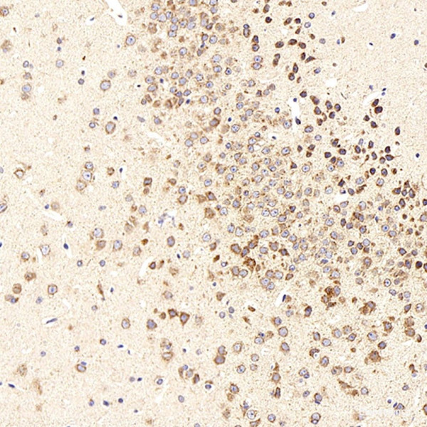 Anti-beta Amyloid
