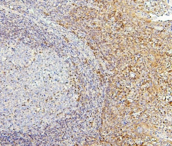 Anti-PPCS / Phosphopantothenoylcysteine synthetase, clone 7G13