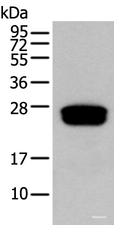 Anti-GLIPR1L1
