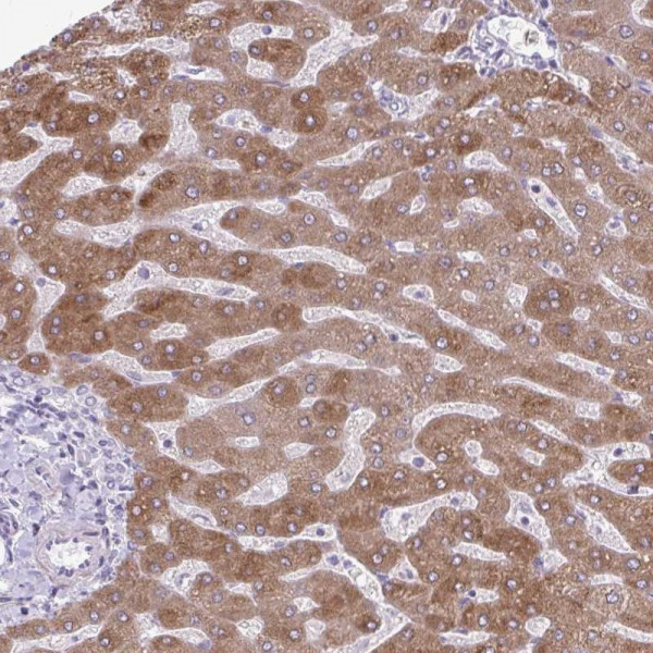 Anti-MSMO1