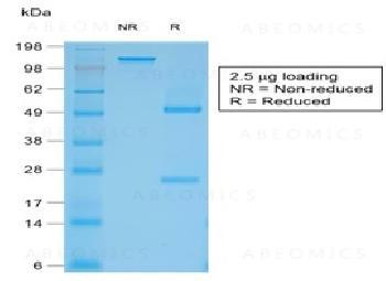 Anti-Filaggrin (Keratinocyte Differentiation Marker) Recombinant Mouse Monoclonal Antibody (clone:rF
