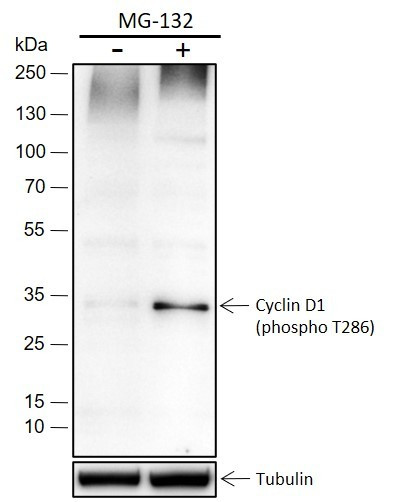 Anti-Recombinant Phospho-Cyclin D1 (Thr286), clone A202