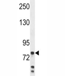 Anti-Myeloperoxidase