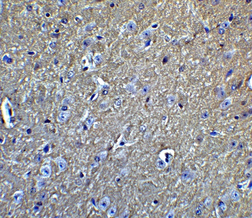 Anti-Amyloid Precursor Protein
