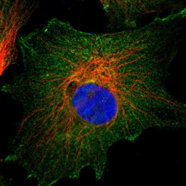 Anti-CD2AP