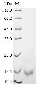 Vesicular glutamate transporter 2 (Slc17a6), partial, rat, recombinant