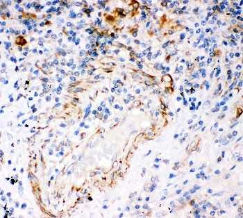 Anti-IP3 Receptor