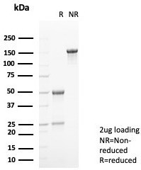 Anti-S100A9 / MRP14 / Calgranulin B / Calprotectin L1H, clone S100A9/7552