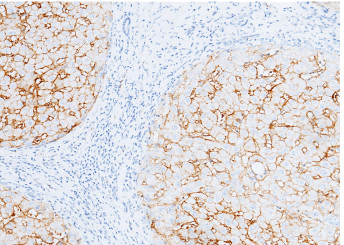 Anti-Carbonic Anhydrase XIV/CA14 Monoclonal Recombinant Antibody