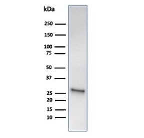 Anti-HSP27 / HSPB1, clone HSPB1/6490R