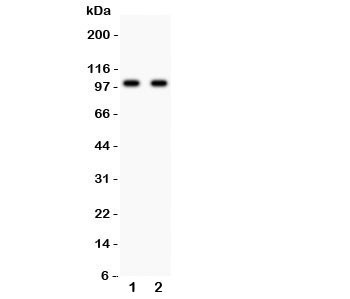 Anti-GLUR4 (Glutamate Receptor 4)