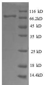 Dolichyl-diphosphooligosaccharide--protein glycosyltransferase 48KDA subunit (RPN1), partial, human,