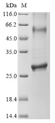 Cyclin-dependent kinase 5 activator 1 (CDK5R1), partial, human, recombinant