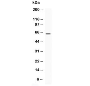 Anti-LBP / Lipopolysaccharide Binding Protein