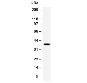 Anti-RPSA / 40S Ribosomal protein SA, clone LMNR-1