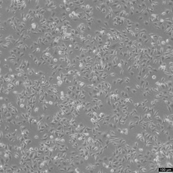OVCAR-5 Cells