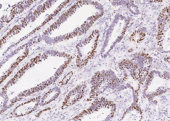 Anti-MSH6/GTBP Monoclonal Recombinant Antibody