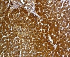 Anti-Glypican-3, clone GPC3/863