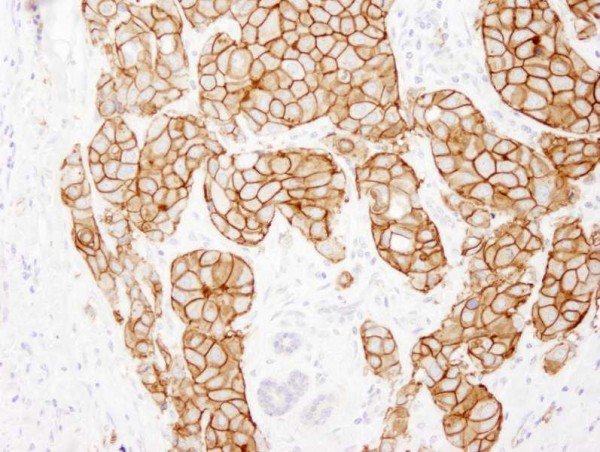 Anti-ErbB2 (IHC)