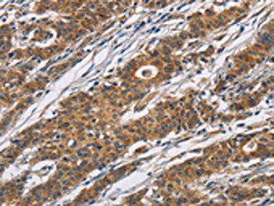 Anti-CYP21A2
