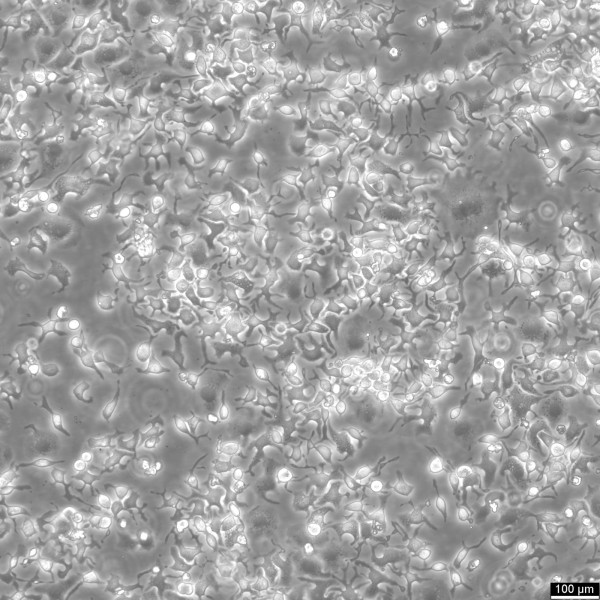 RBL-2H3 Cells