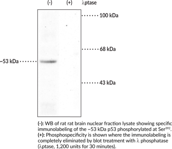 Anti-p53 (Phospho-Ser392)
