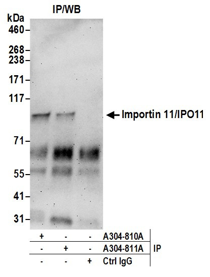 Anti-Importin 11/IPO11