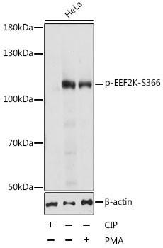 Anti-phospho-EEF2K (Ser366)