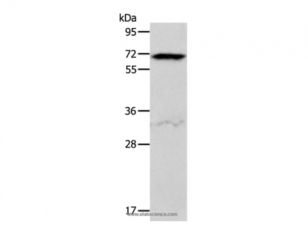 Anti-ACVR2A