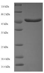 Serine/threonine-protein kinase PAK 5 (PAK5), partial, human, recombinant