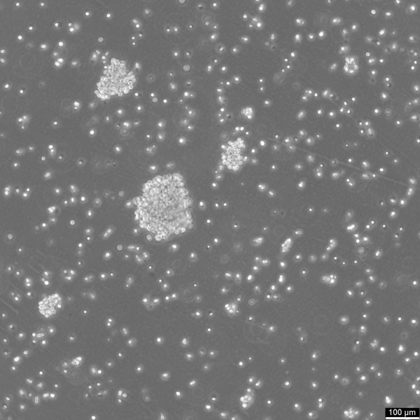 WT100 Cells