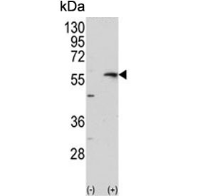 Anti-Collagenase 3 / MMP13