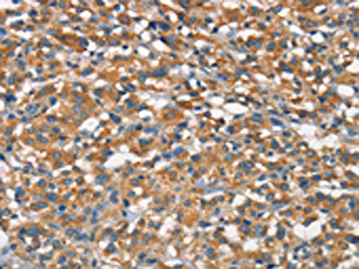Anti-APOA1BP