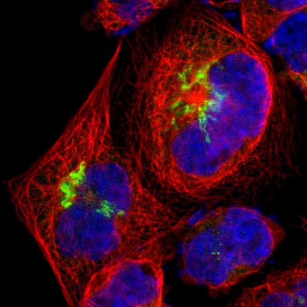 Anti-B4GALT1